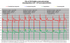 FD35VABH puhalluslämpötilat PE-LA +0.5C-+2C.png